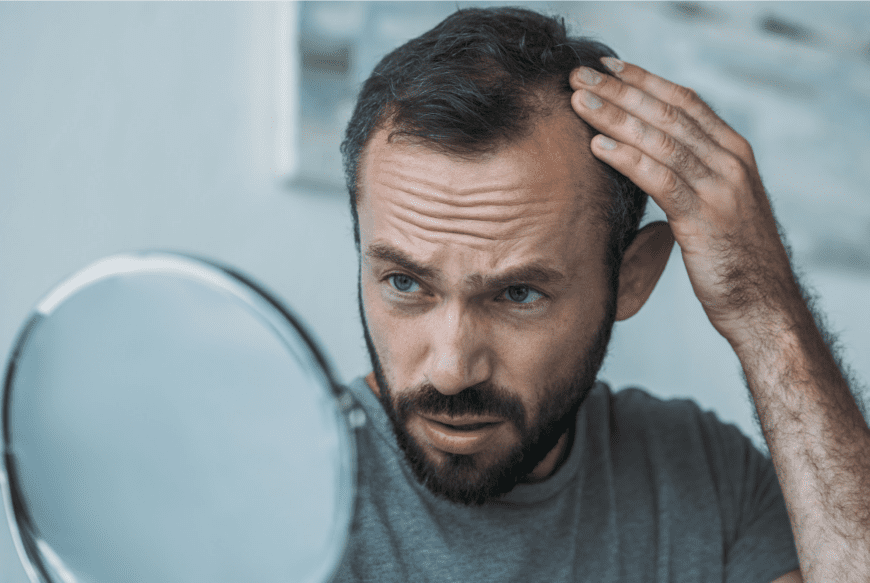 How Much Does A Hair Transplant Abroad Actually Cost? - Make Medical Trip |  Medical Tourism | Find Medical Treatment Abroad