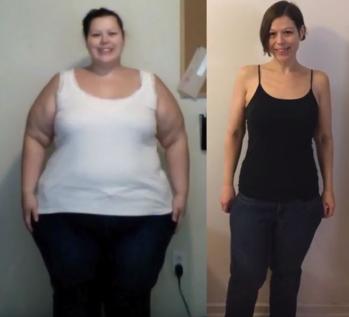 Before and After Michelle