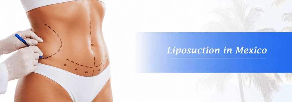 Liposuction Mexico