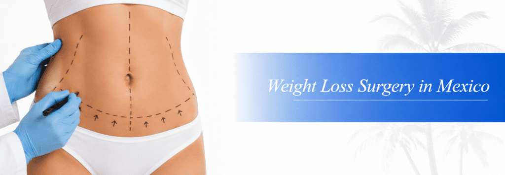 Weight Loss Surgery in Mexico